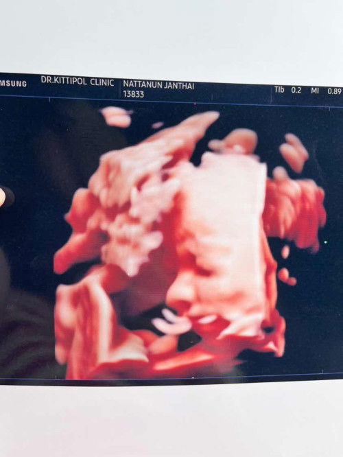 กังวลมากค่ะ แม่ๆช่วยดูหน่อยนะคะ