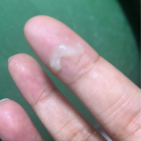 Mucus plug po ba to?