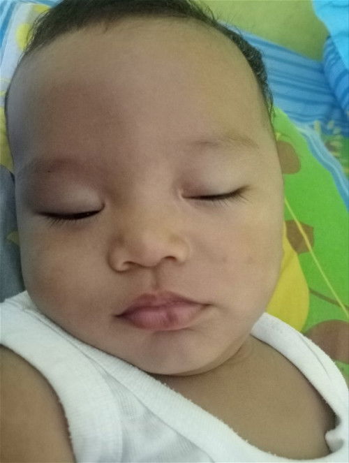 Bibir bawah bayi ada bercak hitam