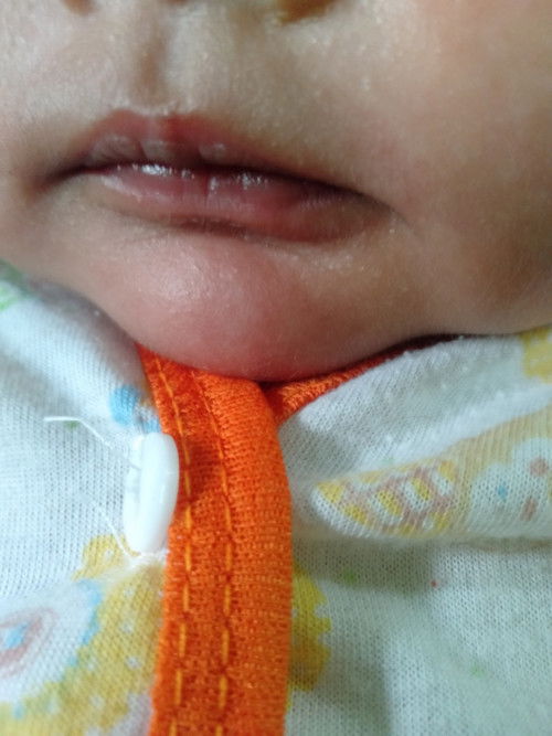 Bibir bayiku warnanya begitu apakah normal bund?