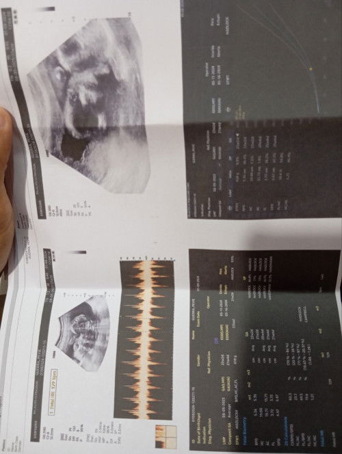 1st time mom question 23 weeks