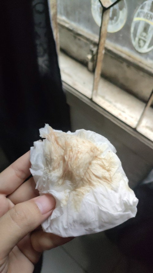 Bunda" mau tanya dong maaf kalau aga sedikit jorok, aku hamil 39 week ,kmren keluar lendir darah sed