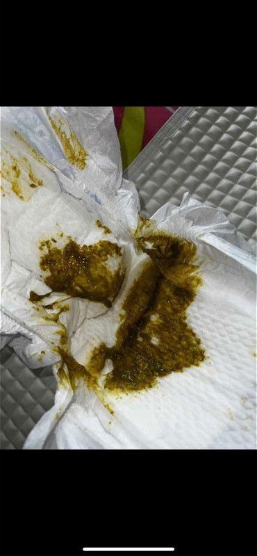 Warna pup/feses bayi