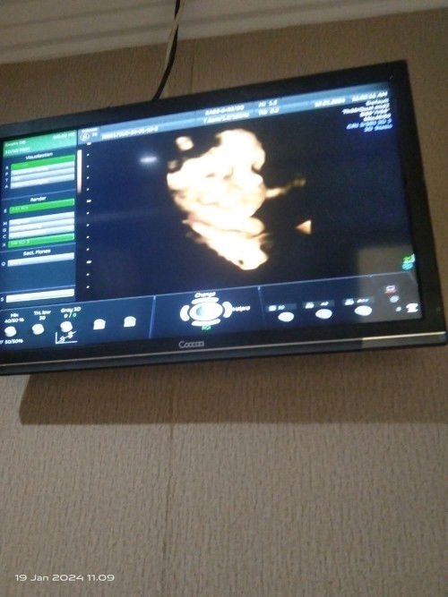 Berbagi kebahagiaan bundaaa