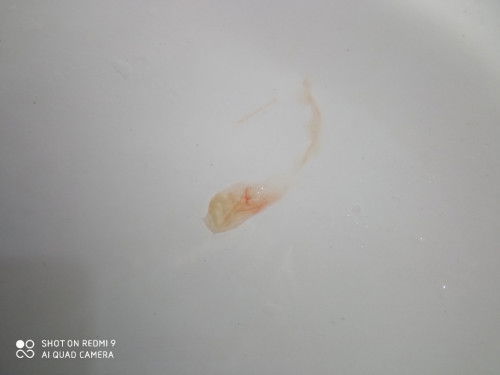 อายุครรภ์ 39+4