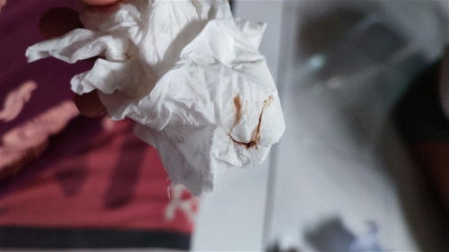 Bund ada yg pernah juga flek? Telat haid 1mgg di TP samar. Keluar flek coklat gini