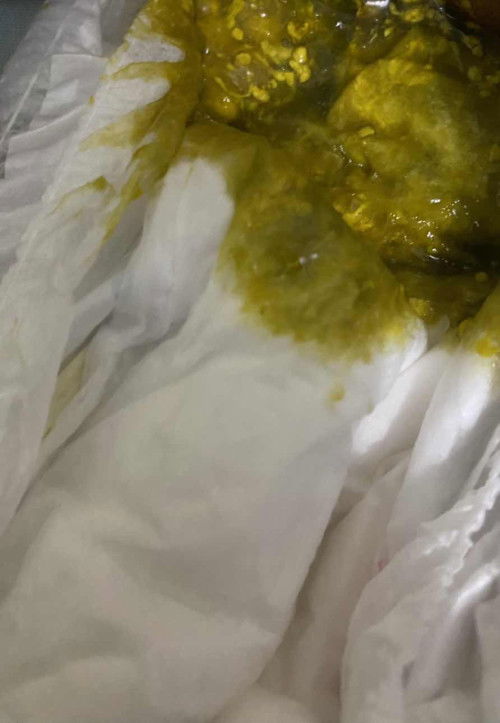 BAB Bayi 2 bulan berwarna hijau tua berlendir full asi