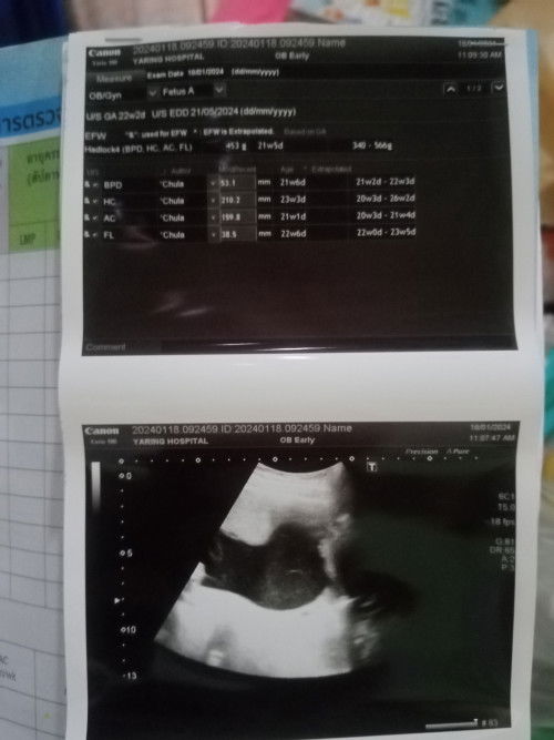 ช่วยตอบหน่อยจ้า