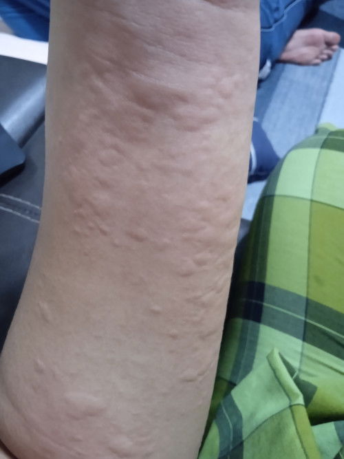 Nie salah satu alahan mengandung ke ?