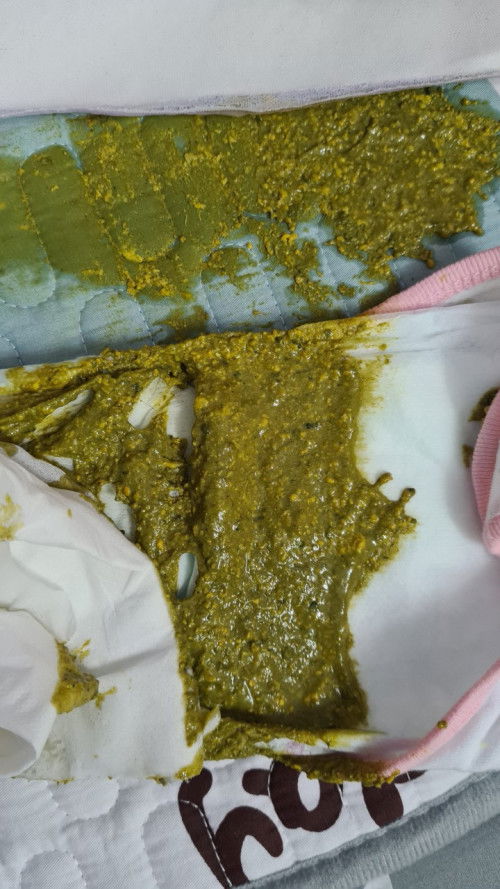 Phân lỏng màu xanh có sao không các mom