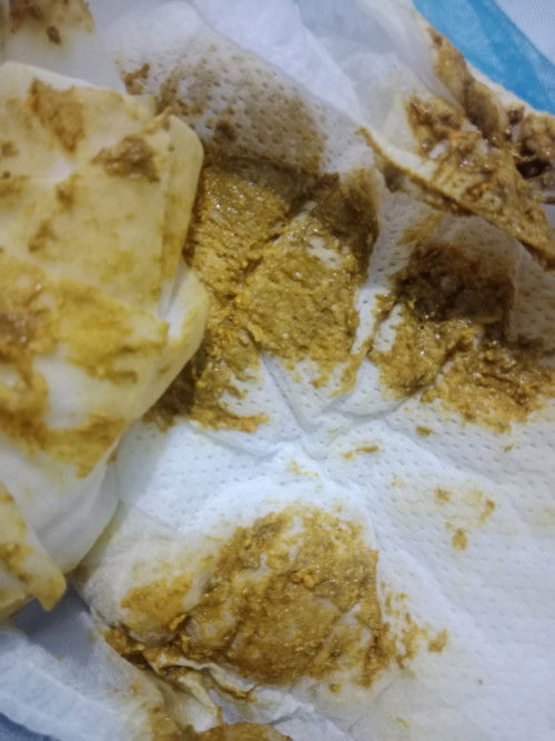 Bé 28 ngày mới đổi sang sửa ct mà đi phân như vậy và có mùi hôi tanh, xì hơi nhiều có sao k mn