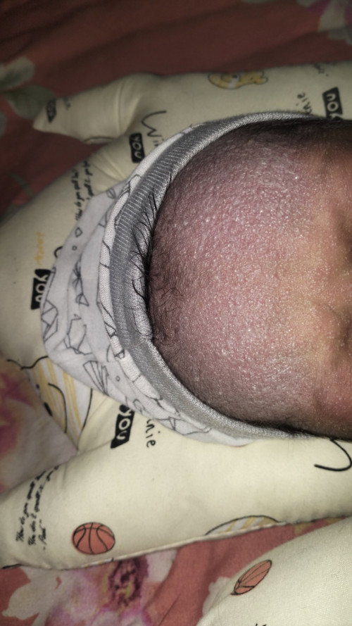 Kulit bayi