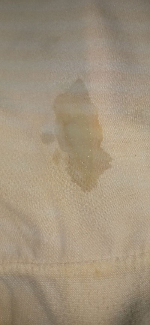 Maaf Bun, mau tanya diusia 36 week hampir setiap hari keluar keputihan trus, bahaya gak ya