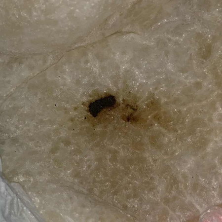 น้อง3เดือน อึเล็ดเป็นสีออกดำๆน้ำตาลๆ