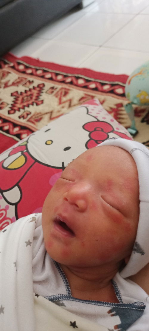 Mohon saran dan kenapa?