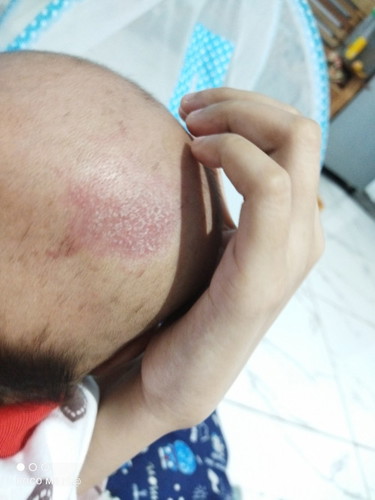 Kepala merah