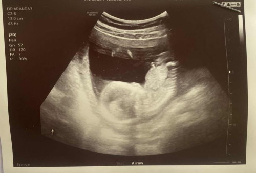 Baby boy or girl?