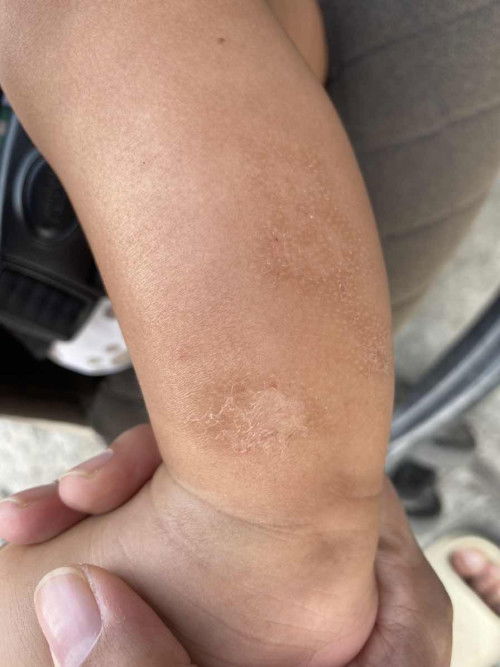 น้องเป็นอะไรคะแบบนี่