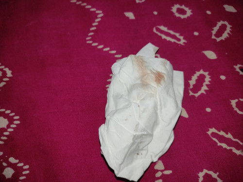 Seputar bertanya tentang flek