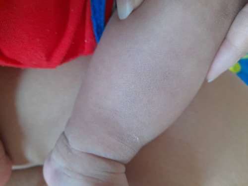 แบบนี้คือน้องเป็นอะไรคะ