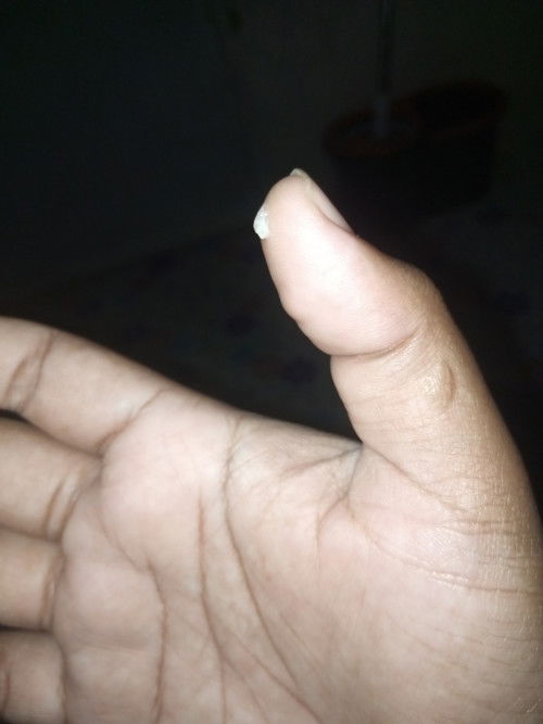 แบบนี้ปกติไหมคะแม่ๆ