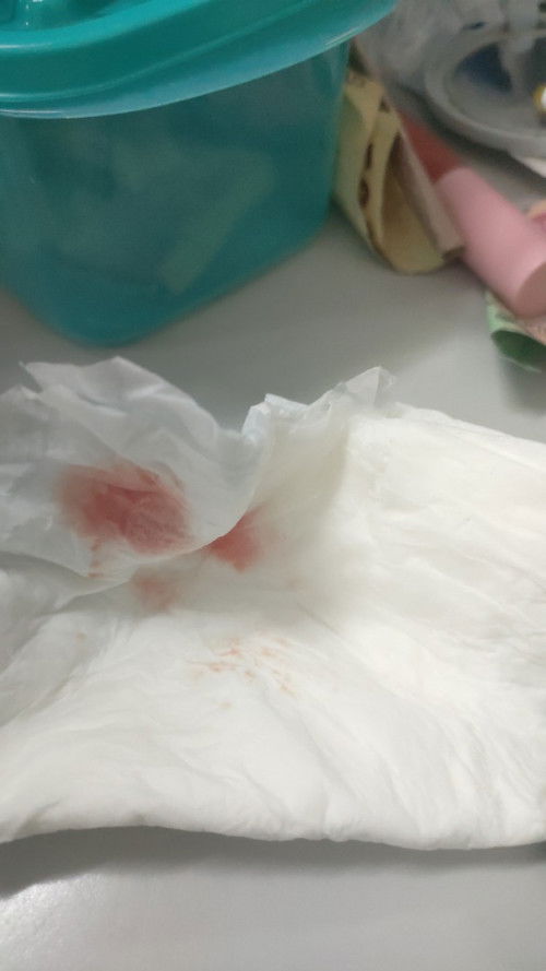 Saya hamil 9mgg dan mengalami flek prut tdak kram dan sakit. Diusg janin nya msih kecil dan kdnag