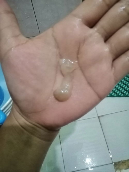 White egg discharge no. Pregnant