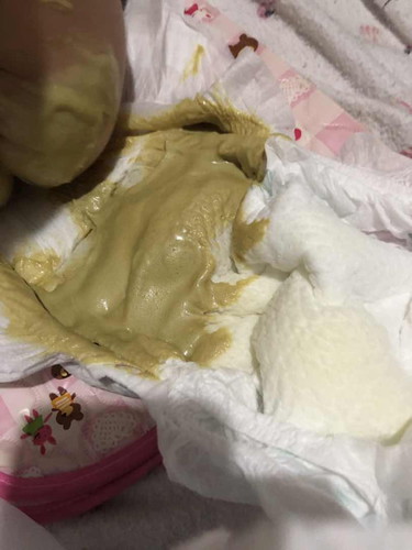 Poops ni baby