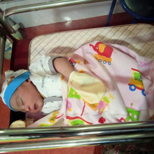 Sudah lahir 37 w 6 hari dengan posisi sungsang/pantat dlu (normal tanpa jait)