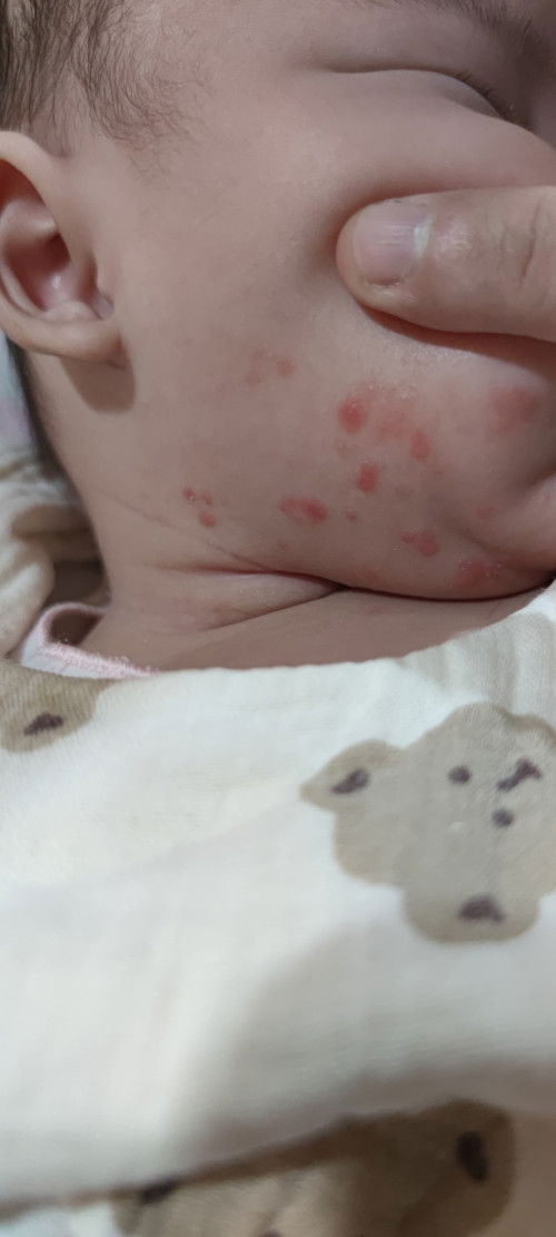 Ada yg pernah kena kyk gini ga ya baby nya ?