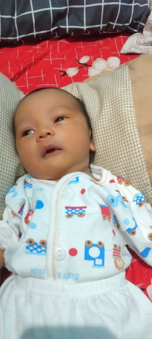 Bayi 15 hari wajah dan matanya kuning