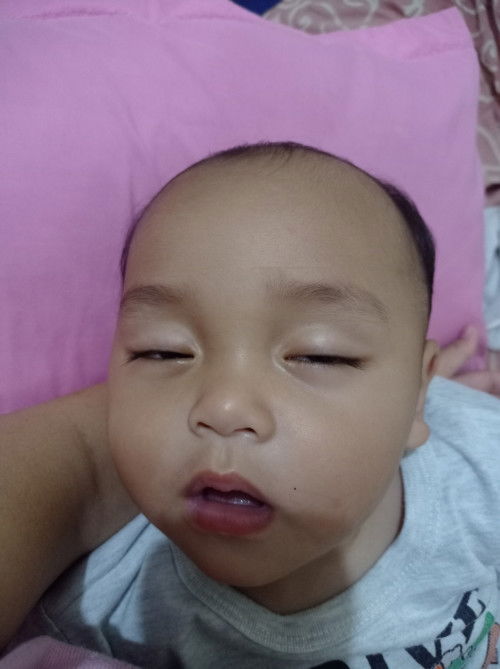 Anakku dehidrasi ga sih ini?