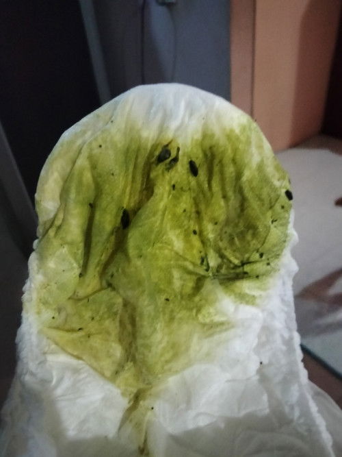 เด็ก10เดือนถ่ายบ่อยมาก