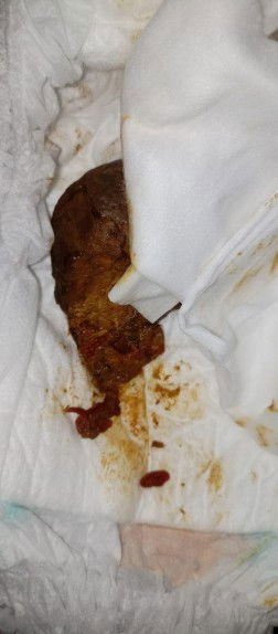 Bab anak usia 15 bulan