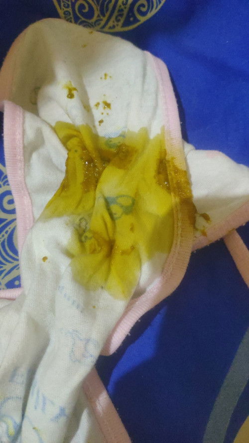 Bayi usia 5hari, PUP sehari 6x wajar kah bun?