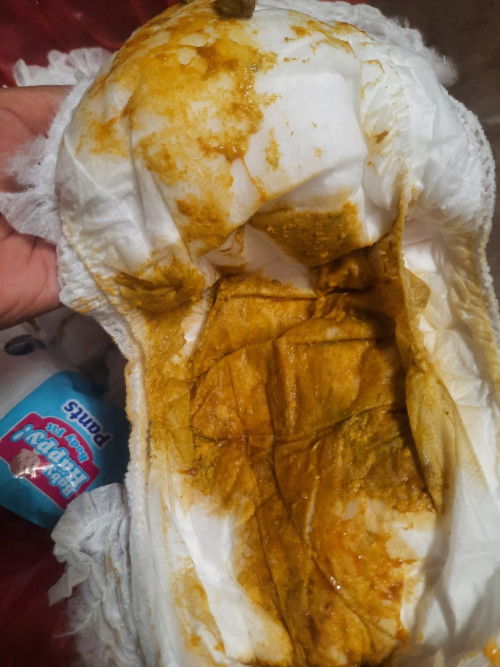 Bund mohon maaf ya. Ini lendir drah atau gmn ya