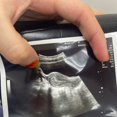 Kantung je ada pregnant ke ?