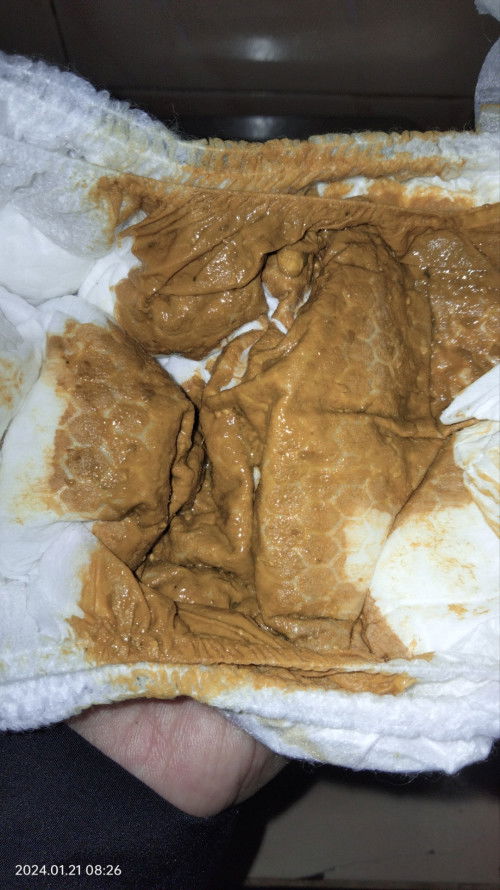 Mau tnya bun bayi 2 blan 10 hri pup ny kya gni wajar ga ya? soalnya lg bapil jga mnum obt dri DSA