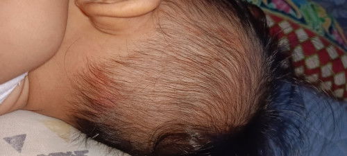 Kepala anak bintik bintik Merah