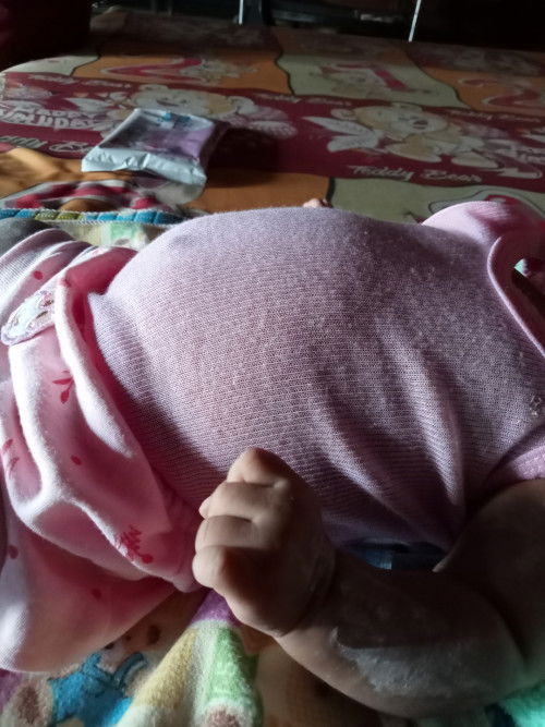 Normal ngak ya Bun,perut baby ku segini kalo hbis nyusu,terlihat besar