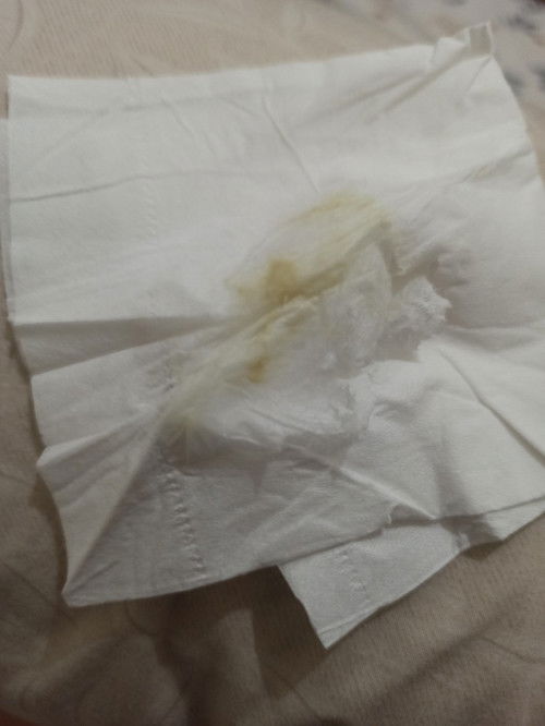 Soal keputihan di TM3