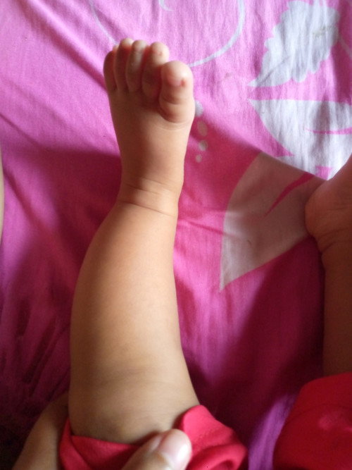 Kaki bayi 5 bulan