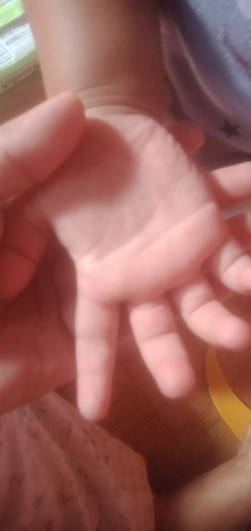 Share .. flu Singapura