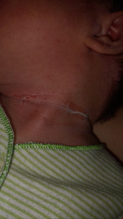 Ruam Leher Bayi