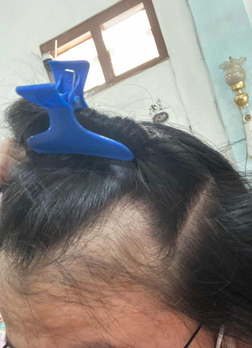 Tips buat busui yang rambutnya rontok parah song bunddd