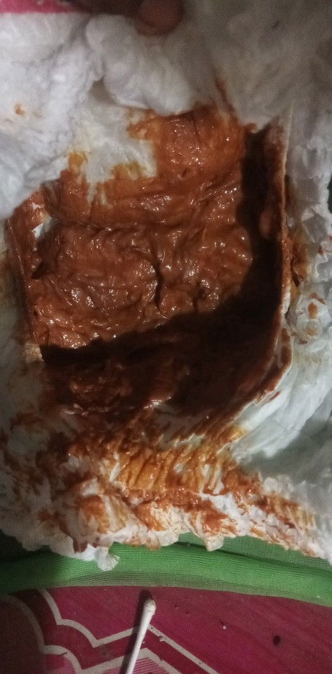 สีอุจาระปกติไหม