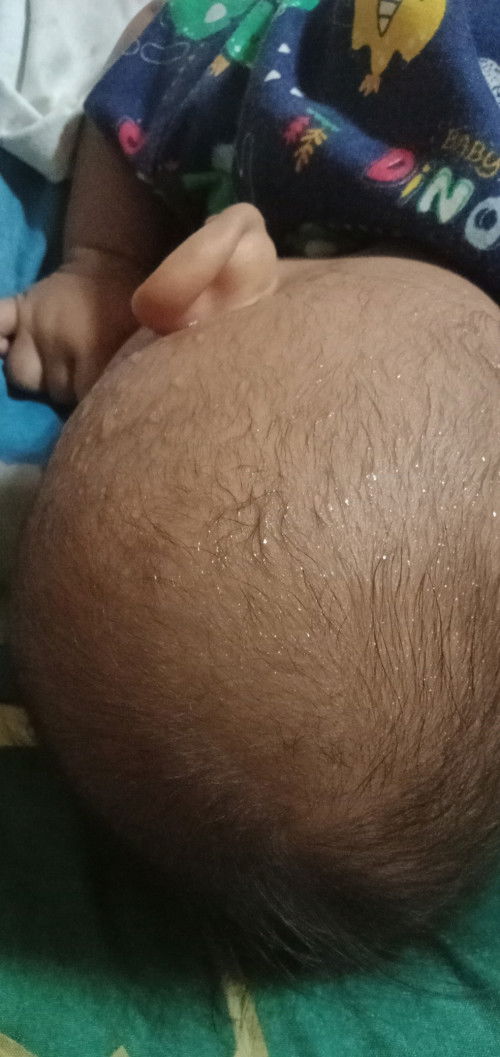 Berkeringat saat tidur