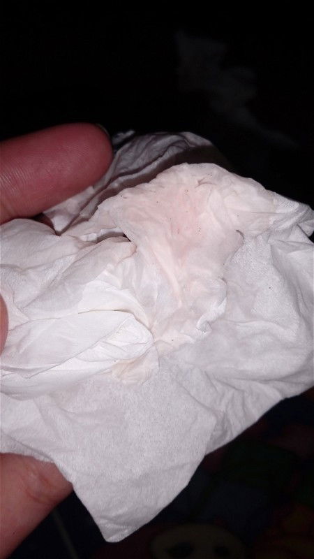 Ini apa? Bahaya atau tidak?