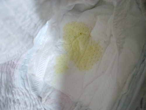 ลูกอายุได้19วันค่ะ