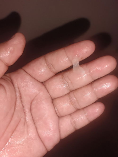 แบบนี้ตกขาวหรือมูกค่ะ37+4